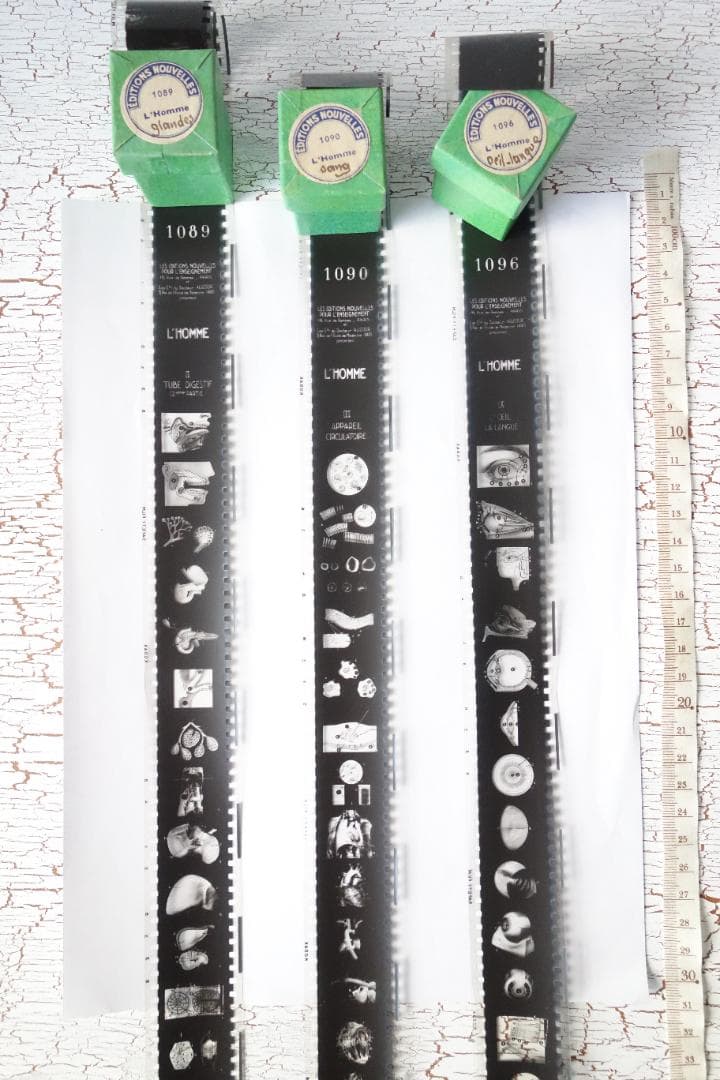 珍しい医療系のフィルム　３本セット