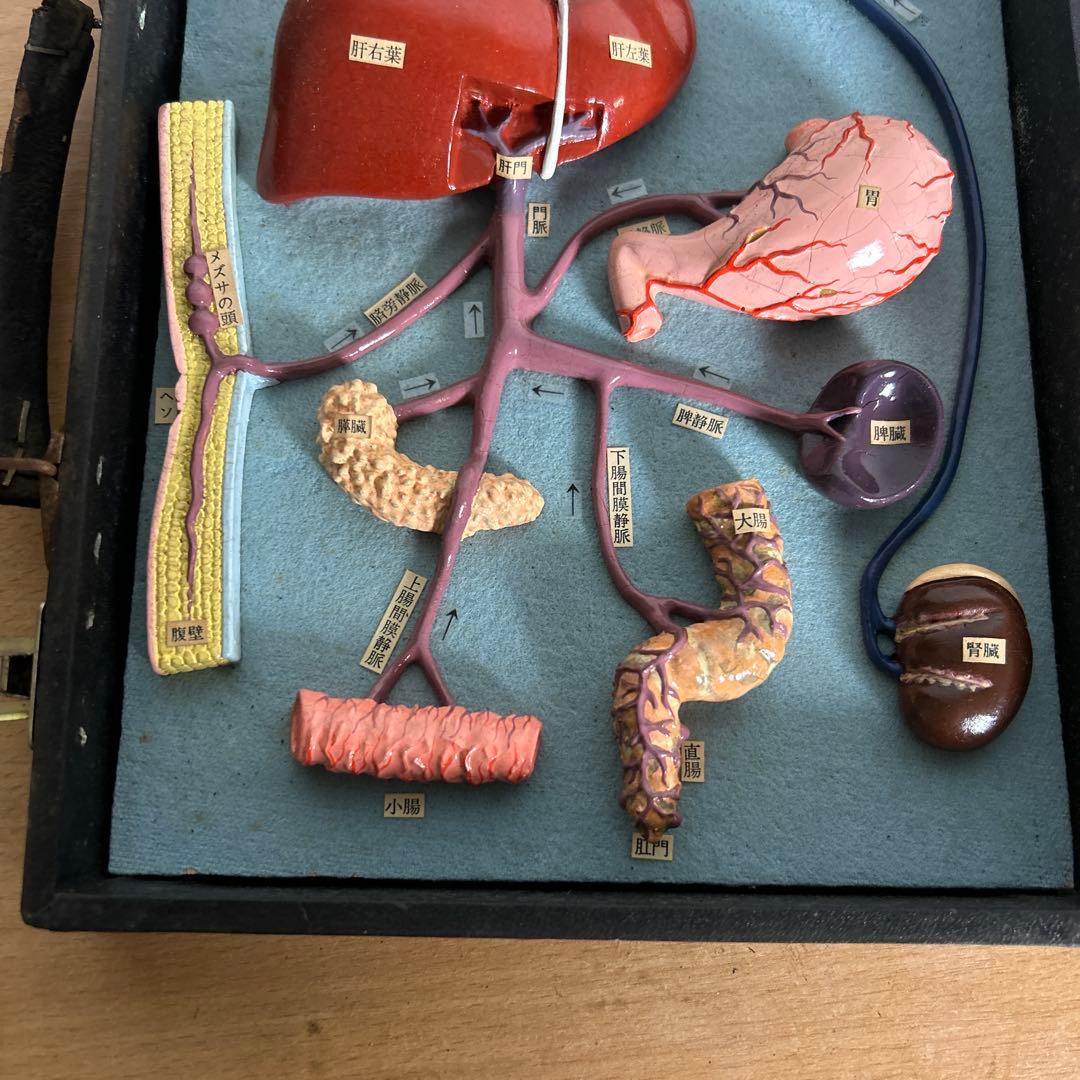 超レア　門脈系模型