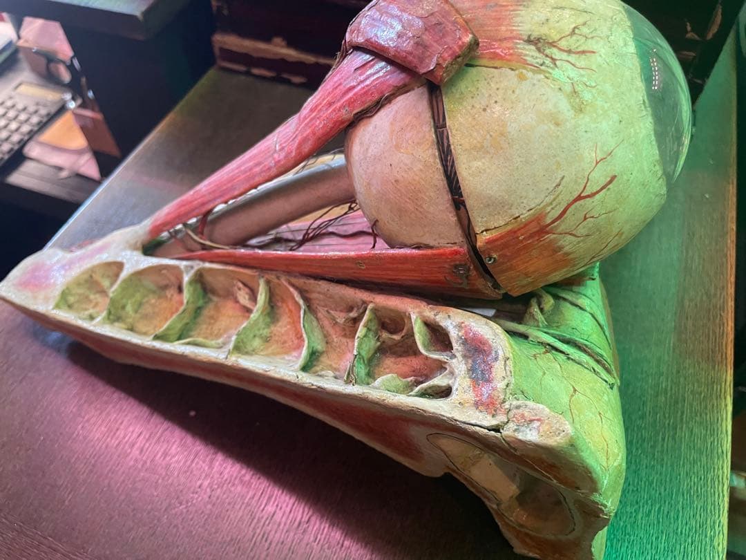 眼球医療用模型