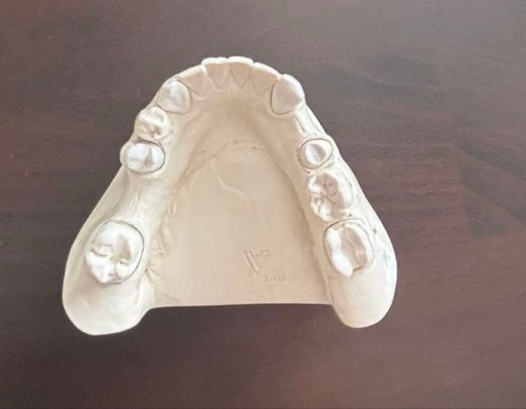 歯科　支台歯形成　練習模型　セット