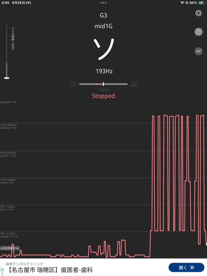 no50チベット産 シンギングボウル 新品 チベタンボウル 15cm AUM
