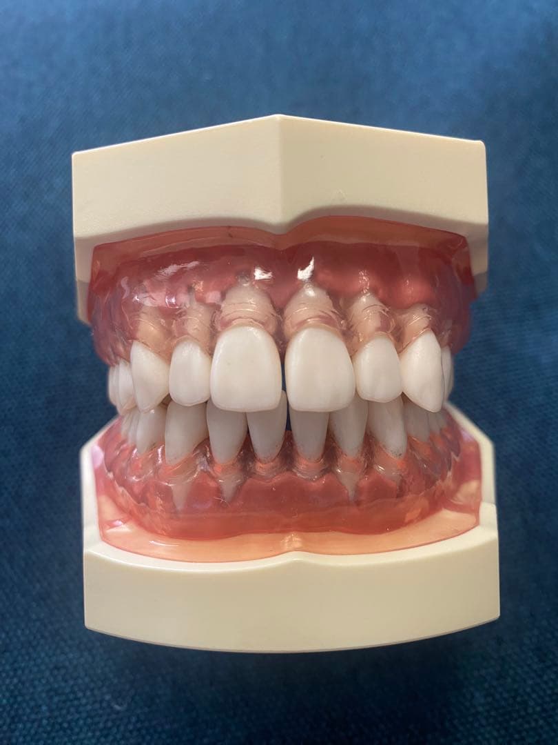 顎模型　人工歯石　セット売り　歯科