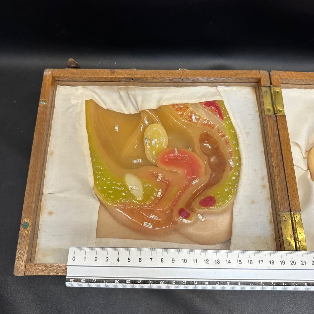 ♡Fc右1008 子宮模型 医療用 断面図 子宮 木製ケース入り 昭和レトロ