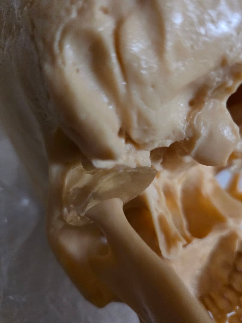 NISSIN DENTAL 頭 歯 模型 アンティーク ガイコツ