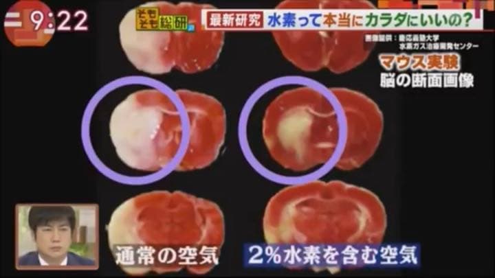 【値下げ】ウイルス対策に必見！H2マルチポッド(水素吸入器・生成器)