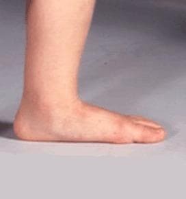 SK8INSOLL® DOUBLE AXEL カスタマイズインソール サイズXS