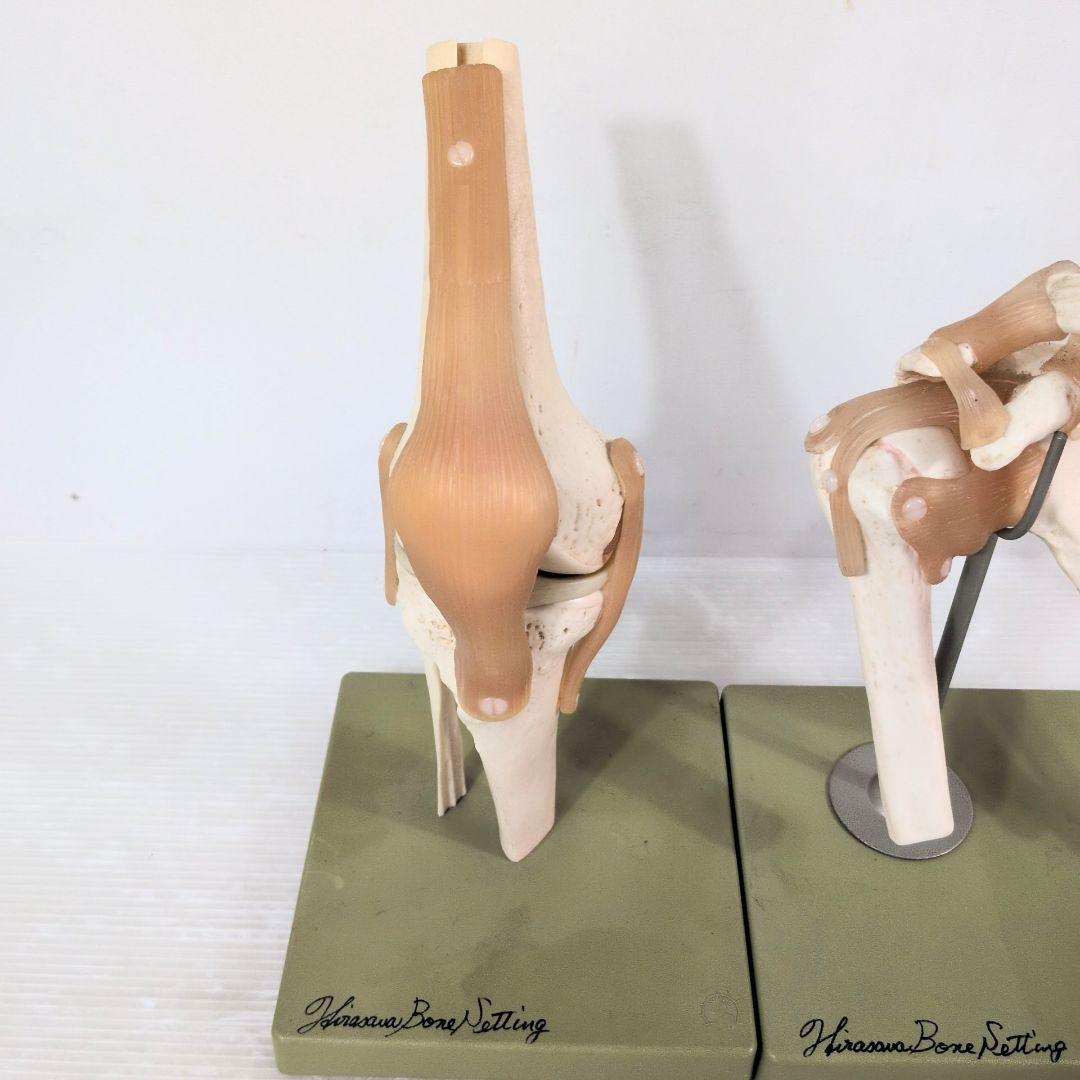 SOMSO 肩関節 膝関節 肘関節 椎間板 模型 ソムソ ドイツ製 人体模型