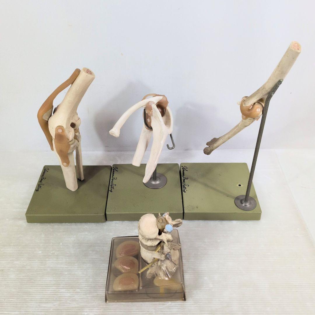 SOMSO 肩関節 膝関節 肘関節 椎間板 模型 ソムソ ドイツ製 人体模型