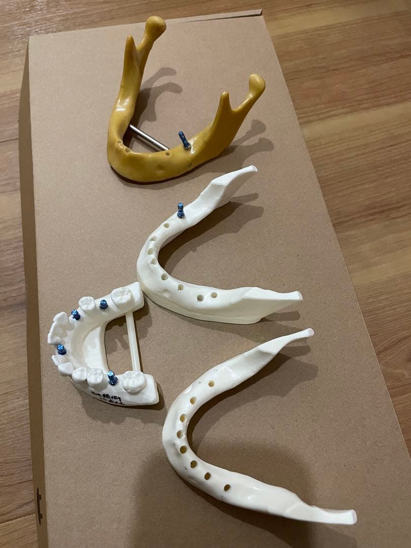 歯科模型 プラスチック製