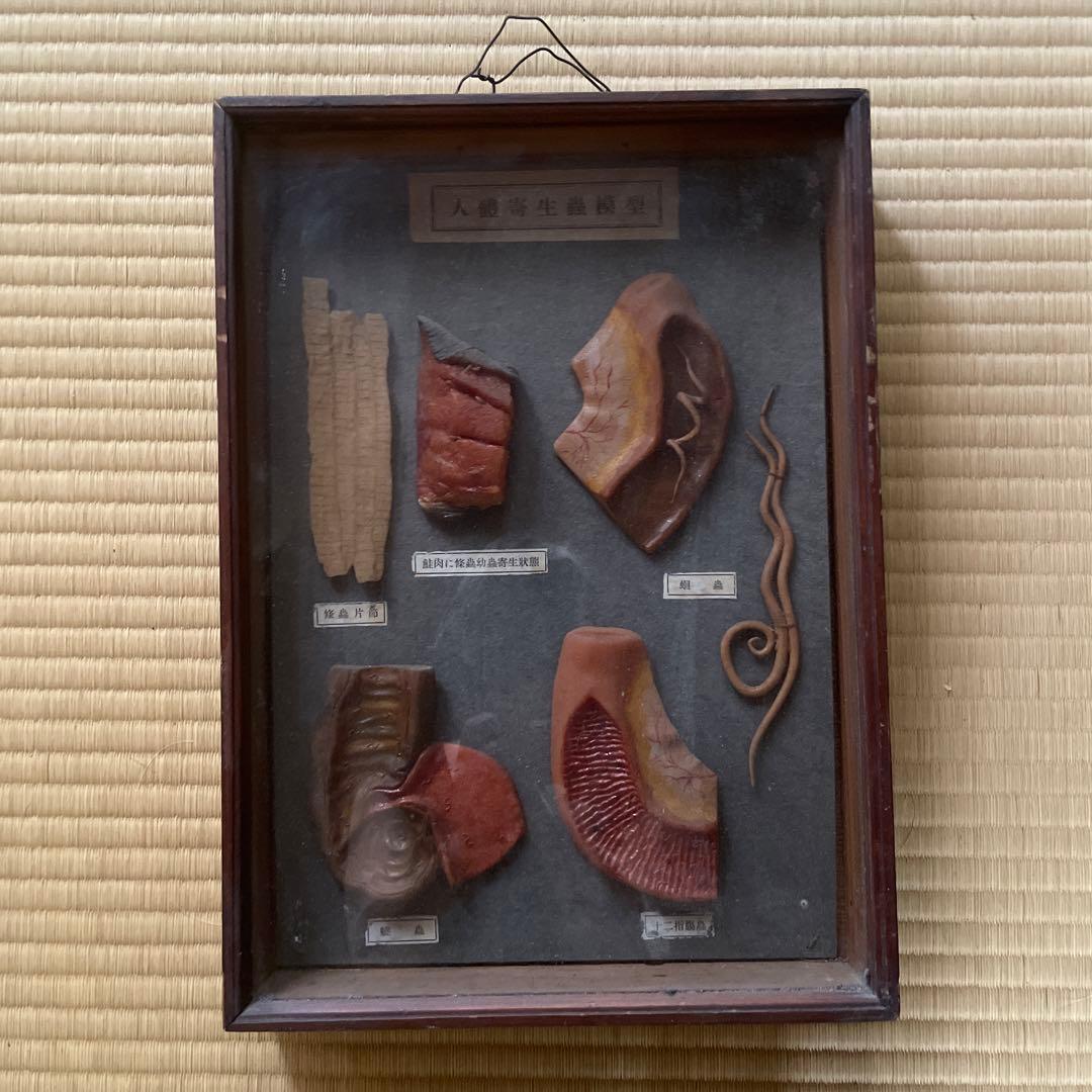 珍品、レトロ　医学模型　寄生虫