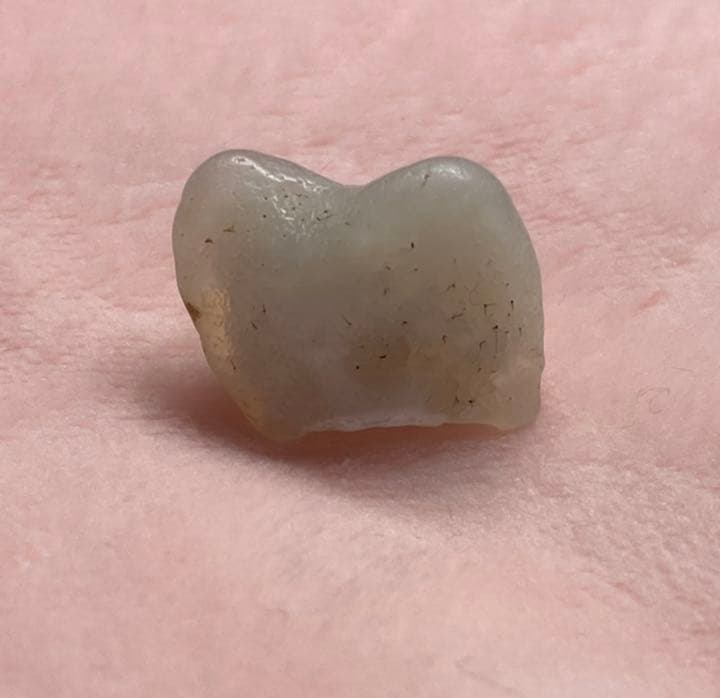 【珍品】京都府産　めのう　原石　歯　国産鉱物　標本　メノウ　瑪瑙