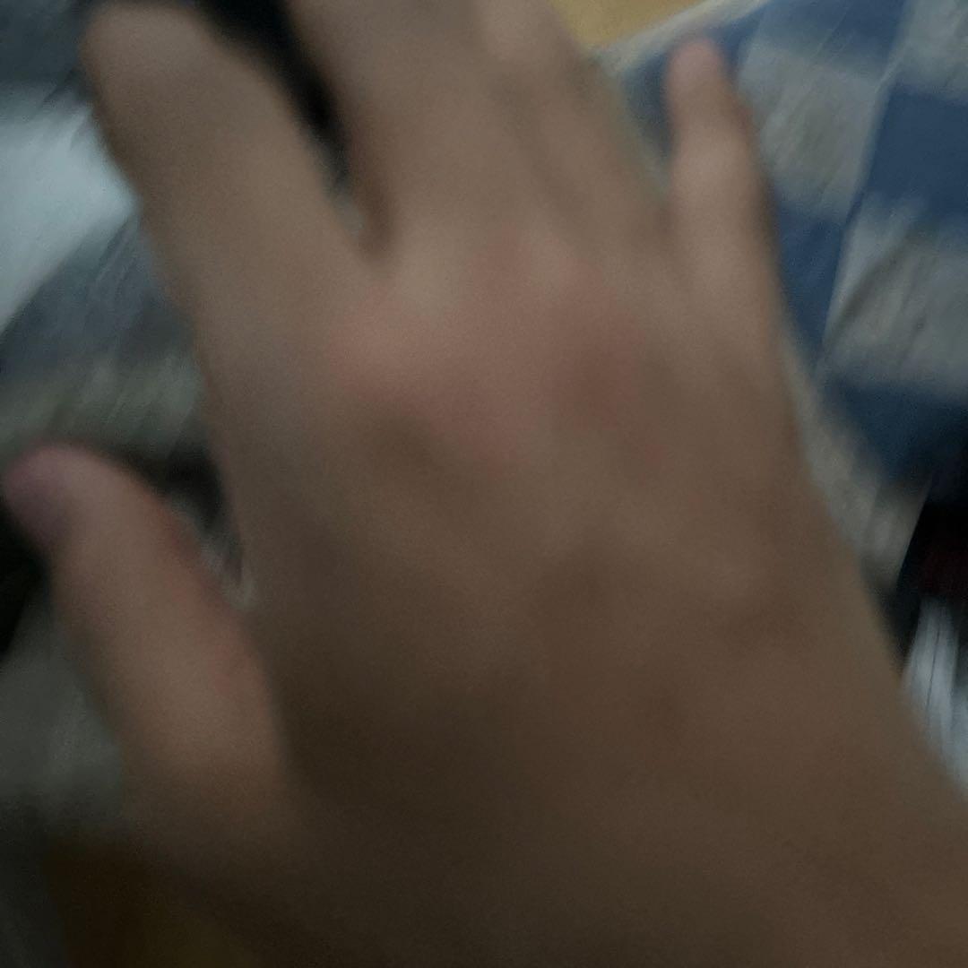 ボウリング用グローブの手の状態