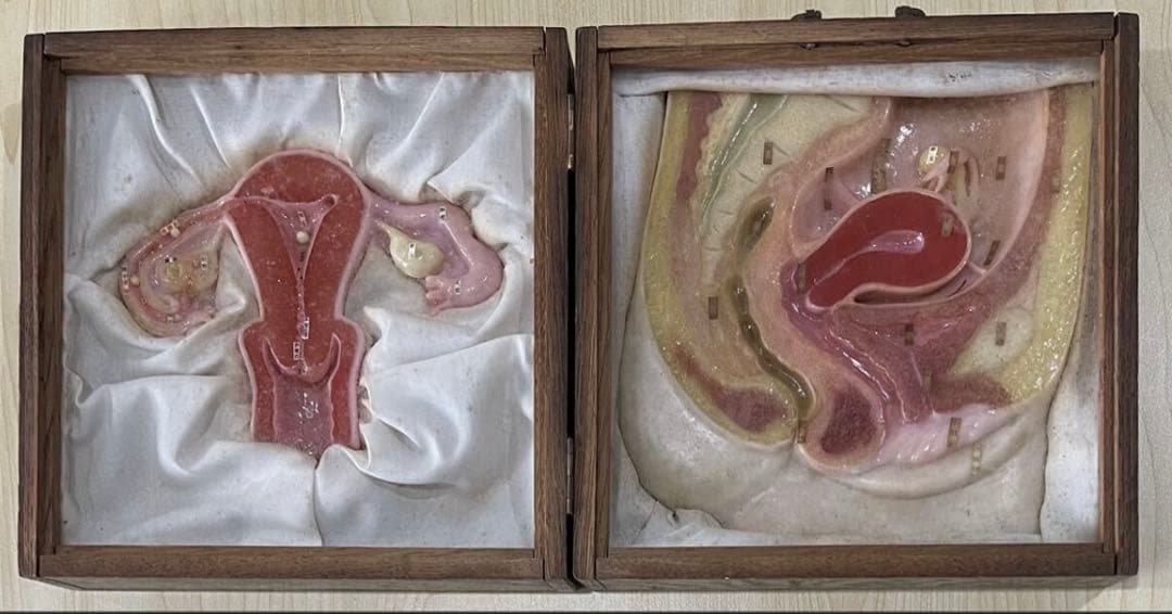 1、医療用 模型 子宮 解剖学的女性生殖器模型 木製ケース入り 送料込みで発送