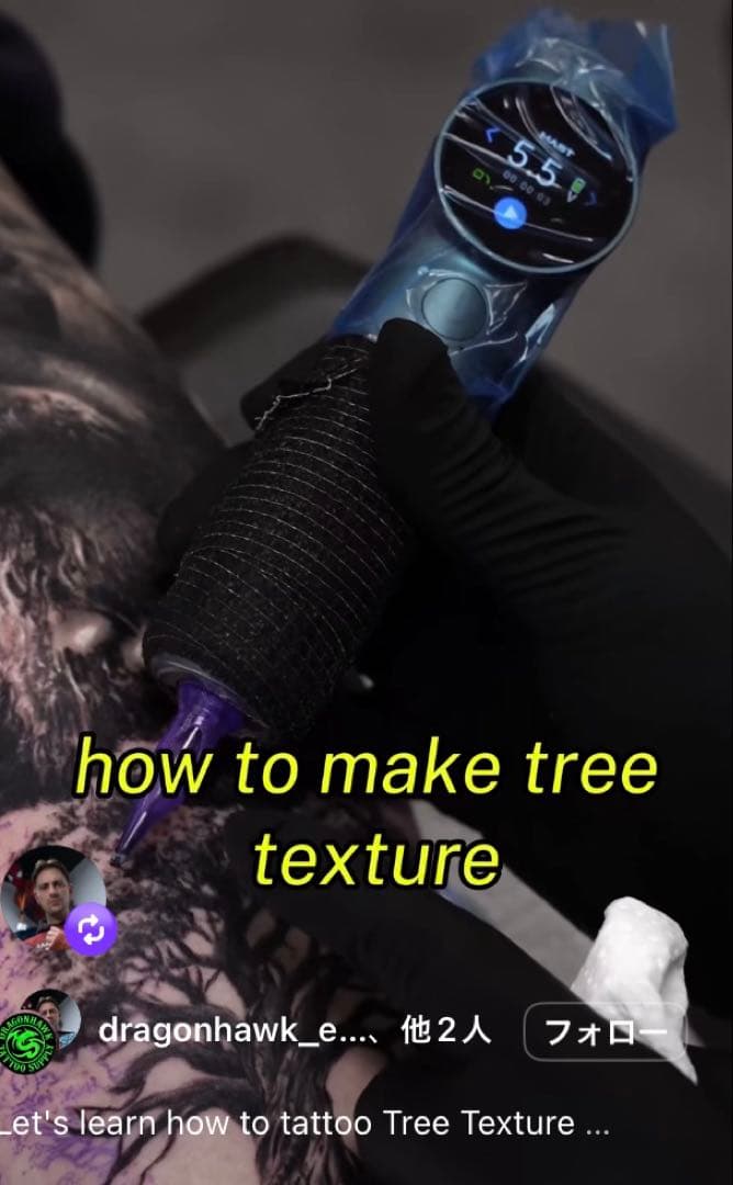 その他 Mast Archer ultra