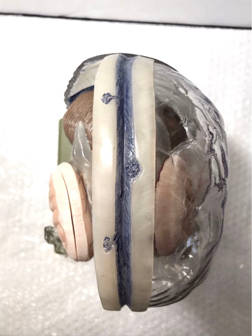 独SOMSO社 (ソムソ社) BS25/T透明な１５分解脳模型♡ 　脳解剖模型