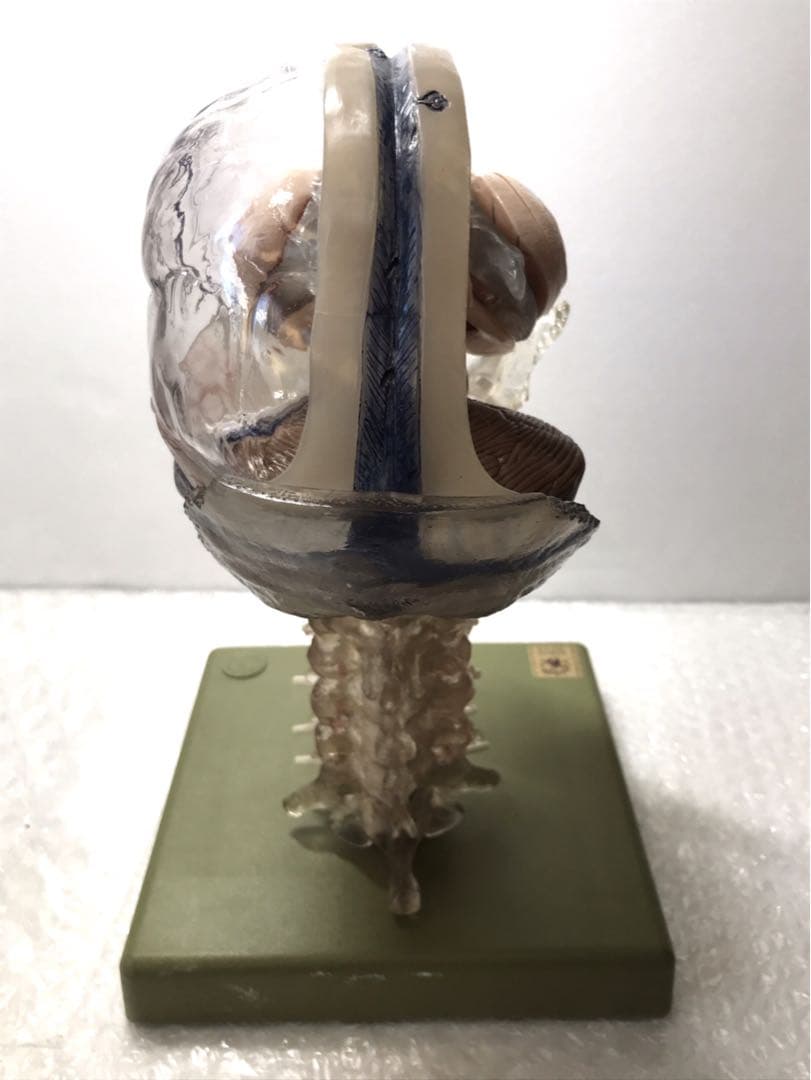 独SOMSO社 (ソムソ社) BS25/T透明な１５分解脳模型♡ 　脳解剖模型