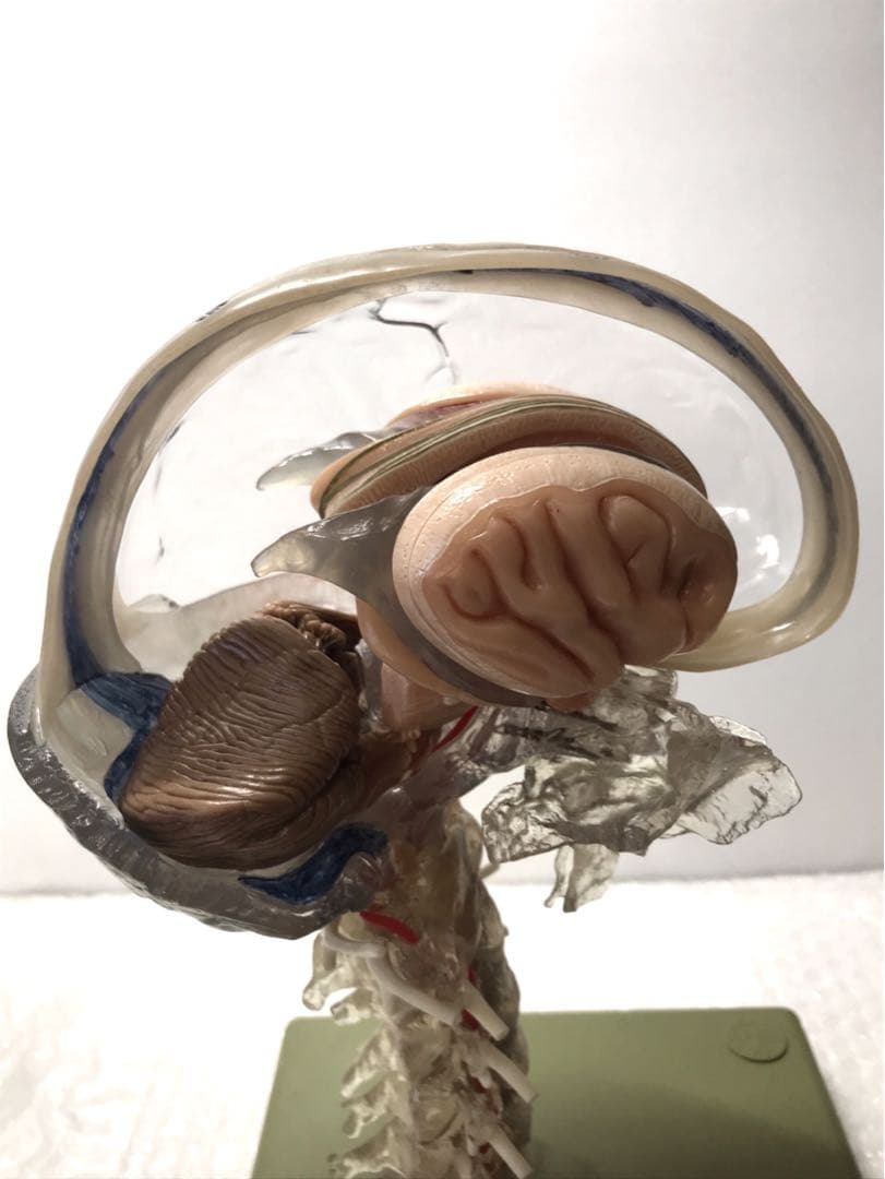 独SOMSO社 (ソムソ社) BS25/T透明な１５分解脳模型♡ 　脳解剖模型