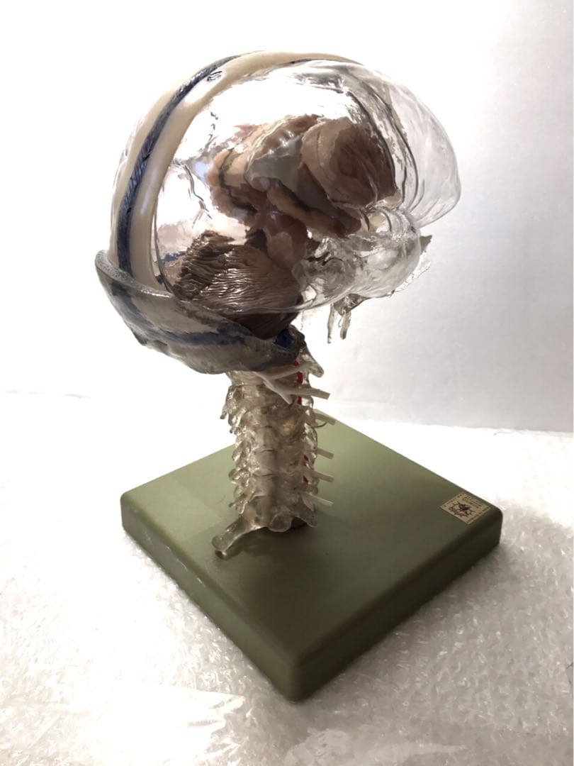 独SOMSO社 (ソムソ社) BS25/T透明な１５分解脳模型♡ 　脳解剖模型